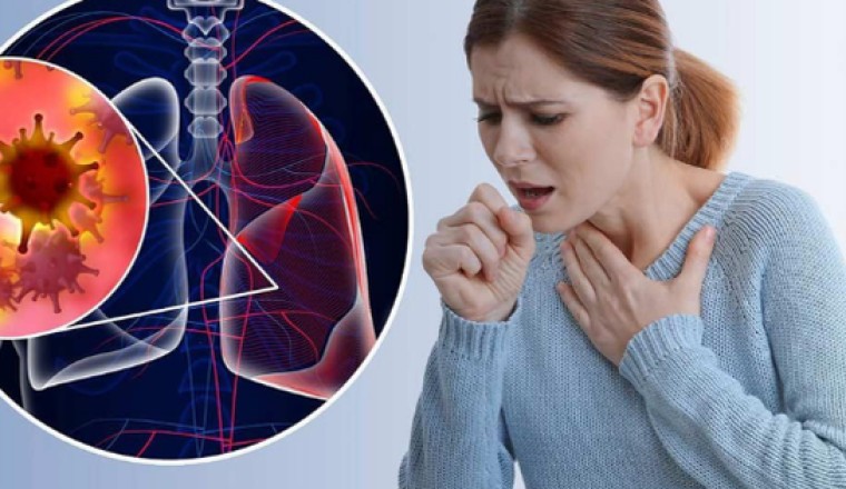 Bài thuốc tốt giúp hỗ trợ người bệnh ung thư phổi sau hóa trị và xạ trị