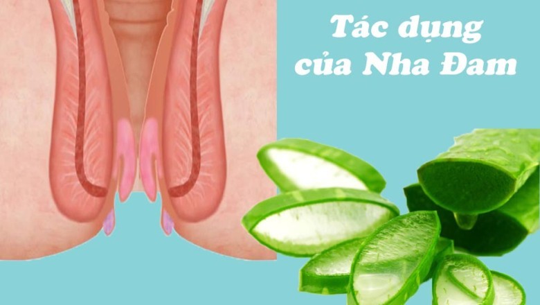 9 Loại Cây Thuốc Nam Hiệu Quả Trong Điều Trị Bệnh Trĩ