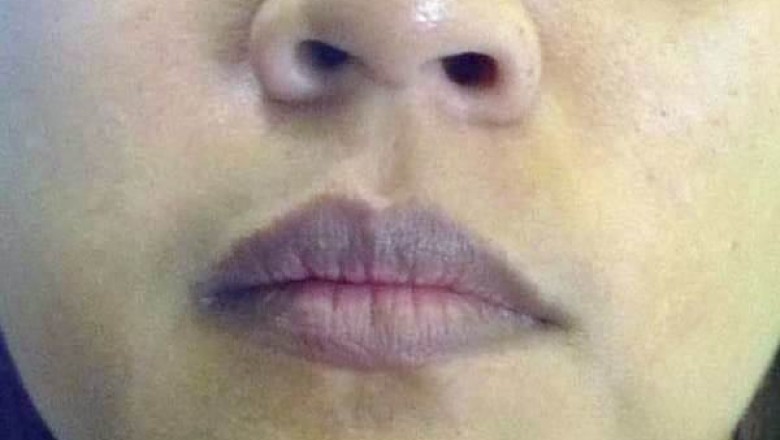 Đàn ông thận yếu thường có 5 điểm chung trên khuôn mặt, soi gương là thấy